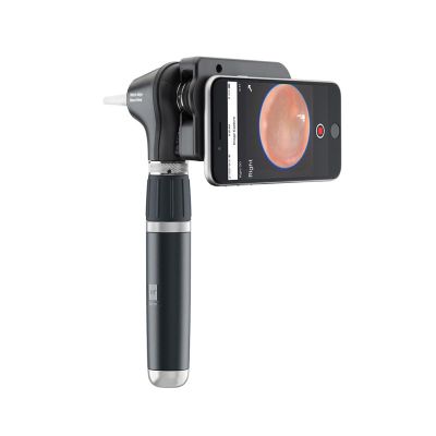 Welch Allyn 71-XM3LXE MacroView Plus iExaminer Otoscope Kit shown with smart phone attached.